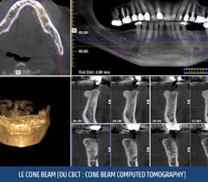 endodontie-biodental-traitement-scanner-dentiste-paris
